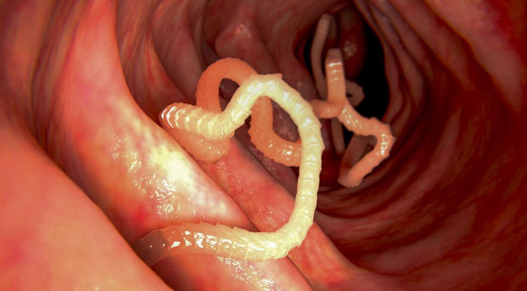 Diagnosis of intestinal parasites
