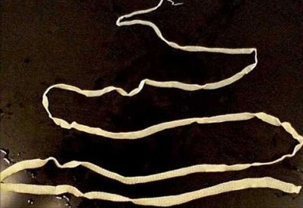 Tapeworms from Humans