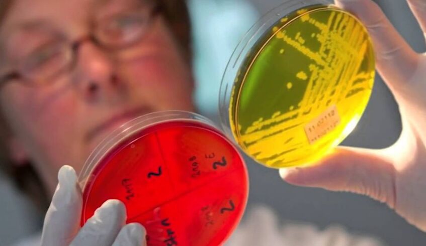 Diagnosing human parasites