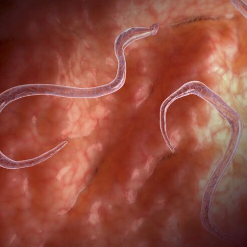 Parasites in the intestine