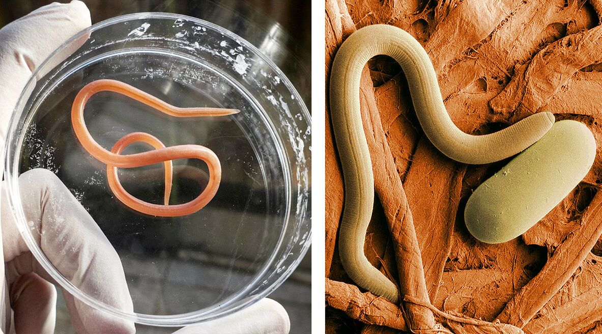 parasites in human body