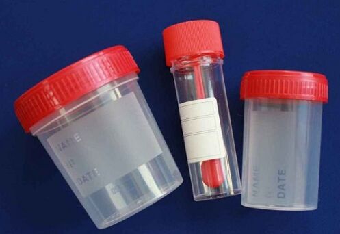 Jars used to test for parasites