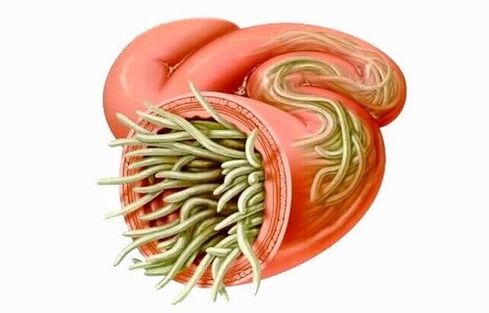 Worms are parasites in the human intestines