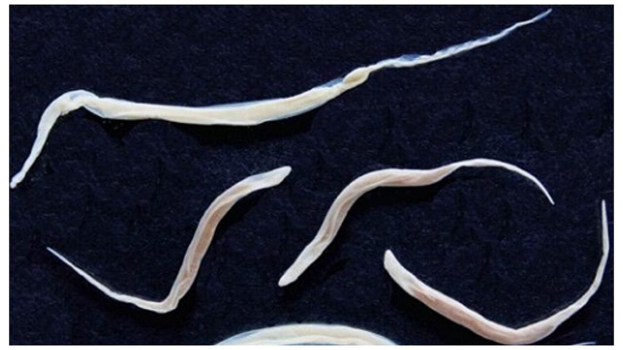 Pinworms are common parasites that belong to the worm family.